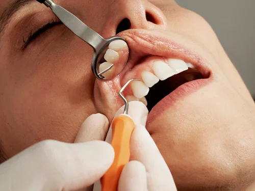 Dental branding